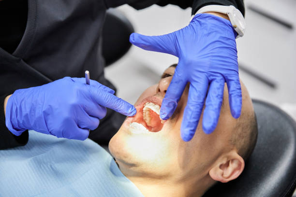 Best Emergency Dentist for Knocked-Out Tooth in Eureka, CA